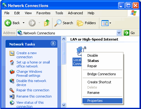 Local Area Connection